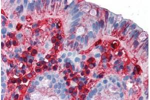 Human Colon (formalin-fixed, paraffin-embedded) stained with IgA antibody ABIN337297 at 10 ug/ml followed by biotinylated anti-mouse IgG secondary antibody ABIN481714, alkaline phosphatase-streptavidin and chromogen. (小鼠 anti-人 IgA Antibody)
