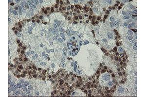 Image no. 2 for anti-GTPase, IMAP Family Member 4 (GIMAP4) antibody (ABIN1498460) (GIMAP4 抗体)