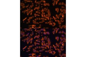 Immunofluorescence analysis of U-2 OS cells using PRX antibody (ABIN7269215) at dilution of 1:100. (Periaxin 抗体  (AA 1250-1350))