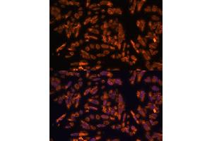 Immunofluorescence analysis of U-2 OS cells using PRX antibody (ABIN7269215) at dilution of 1:100. (Periaxin 抗体  (AA 1250-1350))