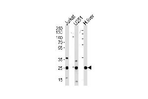 Western blot analysis of lysates from Jurkat, U251 cell line and human liver tissue (from left to right), using GSTM1 Antibody at 1:1000 at each lane. (GSTM1 抗体  (C-Term))