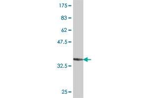 Western Blot detection against Immunogen (37. (LLGL1 抗体  (AA 911-1010))