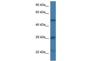 Western Blot showing Gfap antibody used at a concentration of 1. (GFAP 抗体  (N-Term))