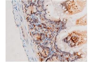 ABIN6267524 at 1/200 staining Mouse intestinal tissue sections by IHC-P. (SYK 抗体  (pTyr525))