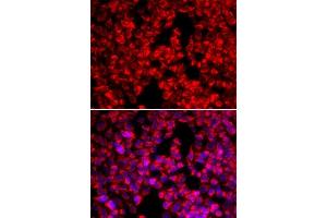Immunofluorescence analysis of U20S cell using MTTP antibody. (MTTP 抗体  (AA 1-130))