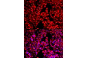 Immunofluorescence analysis of U20S cell using MTTP antibody. (MTTP 抗体  (AA 1-130))