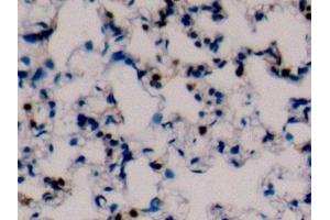 Detection of CD45 in Mouse Lung Tissue using Polyclonal Antibody to Protein Tyrosine Phosphatase Receptor Type C (CD45)