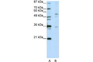 WB Suggested Anti-ZNF57 Antibody Titration:  5. (ZFP57 抗体  (C-Term))