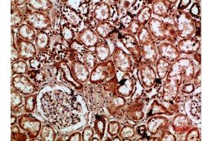 Immunohistochemical analysis of paraffin-embedded human-kidney, antibody was diluted at 1:200 (IMP3 抗体  (AA 135-184))