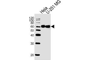 Lane 1: HeLa Cell lysates, Lane 2: U-251 MG Cell lysates, probed with FUBP3 (1216CT820. (FUBP3 抗体)