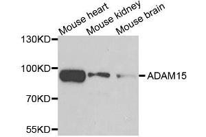 Western blot analysis of extracts of various cell lines, using ADAM15 antibody. (ADAM15 抗体)