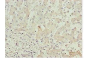 Immunohistochemistry of paraffin-embedded human liver tissue using ABIN7143434 at dilution of 1:100 (ADPGK 抗体  (AA 218-497))