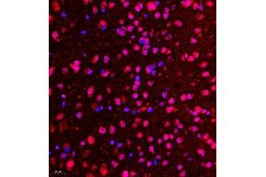 Immunofluorescence of paraffin embedded mouse brain using CDY1 (ABIN7073493) at dilution of 1:400 (400x lens) (CDY1 抗体)