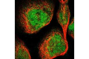 Immunofluorescent staining of A-431 cells using DGKE polyclonal antibody  shows positivity in cytoplasm and nucleus (green) but excluded from the nucleoli. (DGKE 抗体  (AA 63-192))