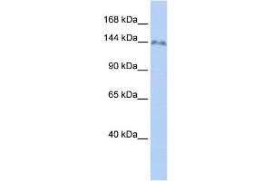 WB Suggested Anti-ZNF862 Antibody Titration:  0. (ZNF862 抗体  (N-Term))