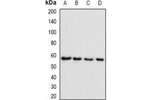 Western blot analysis of SMYD1 expression in Raji (A), MCF7 (B), mouse skeletal muscle (C), rat heart (D) whole cell lysates. (SMYD1 抗体)
