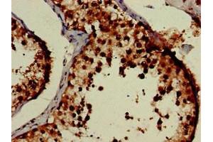 Immunohistochemistry (IHC) image for anti-Eukaryotic Translation Initiation Factor 3, Subunit M (EIF3M) (AA 2-374) antibody (ABIN7152172)