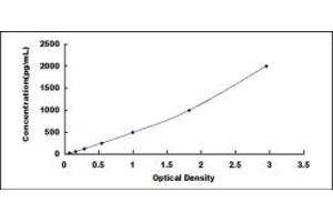 Typical standard curve (CEA ELISA 试剂盒)