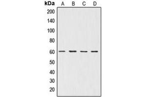 Western blot analysis of AKT expression in A549 (A), NIH3T3 (B), mouse brain (C), rat brain (D) whole cell lysates. (AKT1 抗体  (Center))