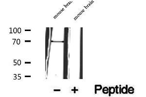 Western blot analysis of extracts of mouse brain tissue, using FOXO6 antibody. (Foxo6 抗体)