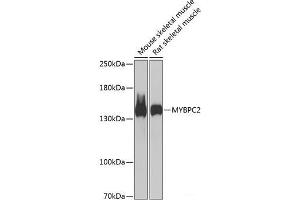 Western blot analysis of extracts of various cell lines using MYBPC2 Polyclonal Antibody at dilution of 1:1000. (MYBPC2 抗体)