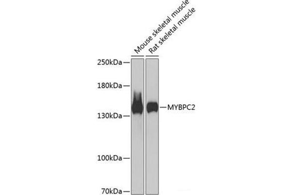 MYBPC2 Antikörper