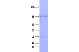 Western Blotting (WB) image for AT Rich Interactive Domain 3B (BRIGHT-Like) (ARID3B) protein (DYKDDDDK Tag) (ABIN2714898)