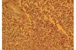 Immunohistochemistry (IHC) image for anti-Chemokine (C-C Motif) Receptor 4 (CCR4) (AA 17-39) antibody (ABIN2478968) (CCR4 抗体  (AA 17-39))