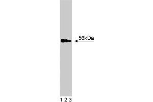 Western blot analysis of MST1 on a Jurkat cell lysate (Human T-cell leukemia, ATCC TIB-152).
