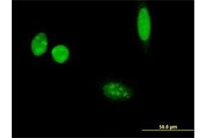 Immunofluorescence of purified MaxPab antibody to THSD3 on HeLa cell. (Isthmin 2 抗体  (AA 1-483))