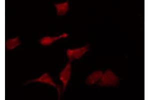 ABIN6275375 staining Hela by IF/ICC. (KCNK6 抗体  (C-Term))