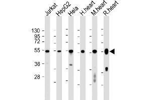 All lanes : Anti-OXCT1 Antibody (Center) at 1:2000 dilution Lane 1: Jurkat whole cell lysates Lane 2: HepG2 whole cell lysates Lane 3: Hela whole cell lysates Lane 4: human heart lysates Lane 5: mouse heart lysates Lane 6: rat heart lysates Lysates/proteins at 20 μg per lane. (OXCT1 抗体  (AA 272-306))