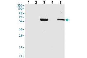 Western blot analysis of Lane 1: RT-4, Lane 2: U-251 MG, Lane 3: Human Plasma, Lane 4: Liver, Lane 5: Tonsil with C1RL polyclonal antibody . (C1RL 抗体)