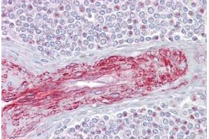 Anti-SLA antibody IHC staining of human spleen. (SLA 抗体  (C-Term))