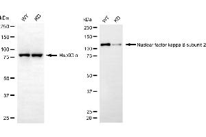 Western blotting analysis using nuclear factor kappa B subunit 2 antibody (ABIN7799635).