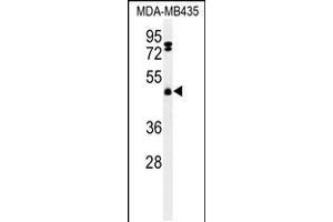 Western blot analysis of FBXL2 Antibody in MDA-MB435 cell line lysates (35ug/lane) (FBXL2 抗体  (C-Term))