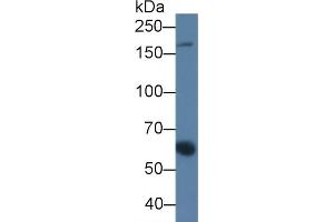 Detection of a2M in Porcine Serum using Monoclonal Antibody to Alpha-2-Macroglobulin (a2M) (alpha 2 Macroglobulin 抗体  (AA 616-856))