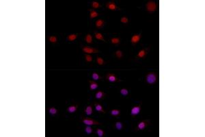 Immunofluorescence analysis of NIH/3T3 using SUPT16H (SPT16) antibody (ABIN7267097) at dilution of 1:100 (40x lens). (SUPT16H 抗体)