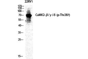 Western Blot analysis of 22RV1 cells using Phospho-CaMKIIβ/γ/δ (T287) Polyclonal Antibody diluted at 1:500. (CaMKIIbeta/gamma/delta 抗体  (pThr287))