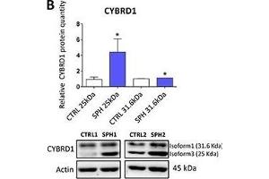 Expression of cytochrome b reductase (CYBRD1) and transferrin receptor 1 (TFR1) participating in iron uptake is higher in tumor-initiating cells (TICs)Expression of the CYBRD1 gene at the mRNA level in breast non-malignant cell line MCF10A, in TICs derived from breast cancer cell lines MCF-7, BT-474, T-47D and ZR-75-30 as well as from prostate cancer cell lines DU-145 and LNCaP has been determined (A) together with protein levels in the MCF-7 cell line (CTRL) and MCF-7 derived spheres (SPH) (B). (Cytochrome B Reductase 1 抗体  (AA 51-150))