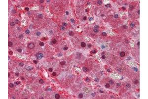 Immunohistochemical analysis of paraffin-embedded human Liver tissues using LPA mouse mAb (Lp(a) 抗体)