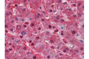 Immunohistochemical analysis of paraffin-embedded human Liver tissues using LPA mouse mAb (LPA 抗体)