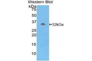 Detection of recombinant PCK1 using Polyclonal Antibody to Phosphoenolpyruvate Carboxykinase 1, Soluble (PCK1) (PCK1 抗体  (AA 311-558))