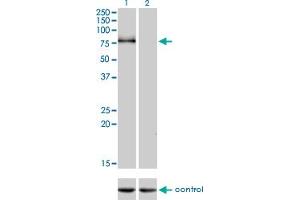 Western blot analysis of CDH6 over-expressed 293 cell line, cotransfected with CDH6 Validated Chimera RNAi (Lane 2) or non-transfected control (Lane 1).
