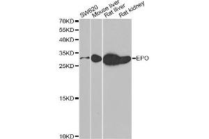 Western blot analysis of extracts of various cell lines, using EPO antibody (ABIN5973306) at 1/500 dilution.