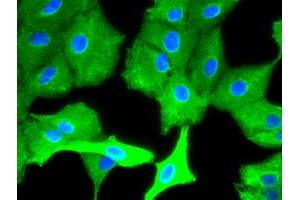 Image no. 2 for anti-Keratin 8 (KRT8) (AA 91-381) antibody (ABIN1491713) (KRT8 抗体  (AA 91-381))