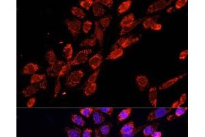 Immunofluorescence analysis of NIH/3T3 cells using EIF4EBP1 Polyclonal Antibody at dilution of 1:100. (eIF4EBP1 抗体)