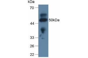 Detection of APOL2 in Rat Lung Tissue using Polyclonal Antibody to Apolipoprotein L2 (APOL2)