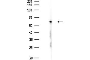 Western blot analysis of lysates from EC304 cells(UV,30 min treatment), using SNRP70 Antibody at 1/1000 dilution.