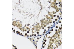 Immunohistochemistry of paraffin-embedded rat testis using DDX41 antibody (ABIN5973951) at dilution of 1/100 (40x lens). (DDX41 抗体)